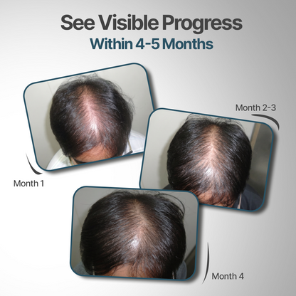 Hair Fact- Cyclical Nutrition Supplement Kit